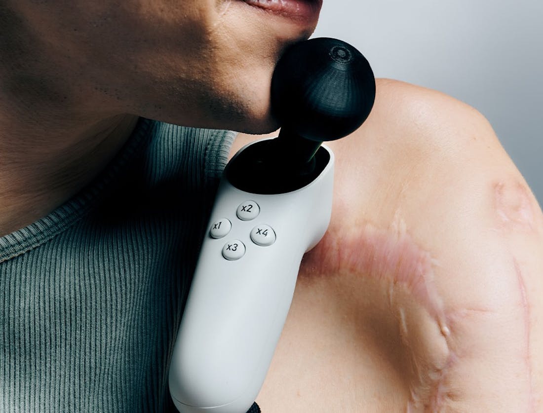 Xbox Adaptive Joystick Xbox Adaptive Joystick nu verkrijgbaar via Xbox Store